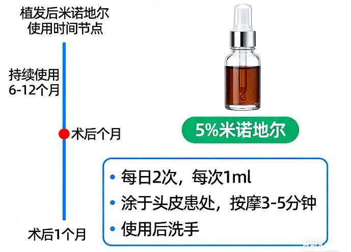植发后米诺地尔使用黄金时间表：3大阶段+5大禁忌，科学用药不踩坑！